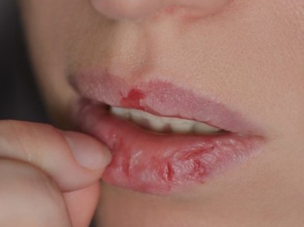 Έσκασαν τα χείλη σας; Αυτές οι μάσκες θα σας σώσουν!