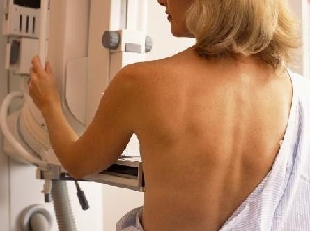 Δωρεάν μαστογραφίες σε άπορες γυναίκες στη Χαλκίδα