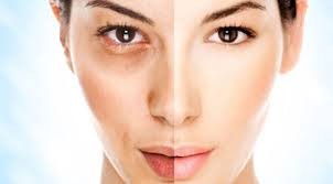 Λαμπερή επιδερμίδα μέσα στο χειμώνα