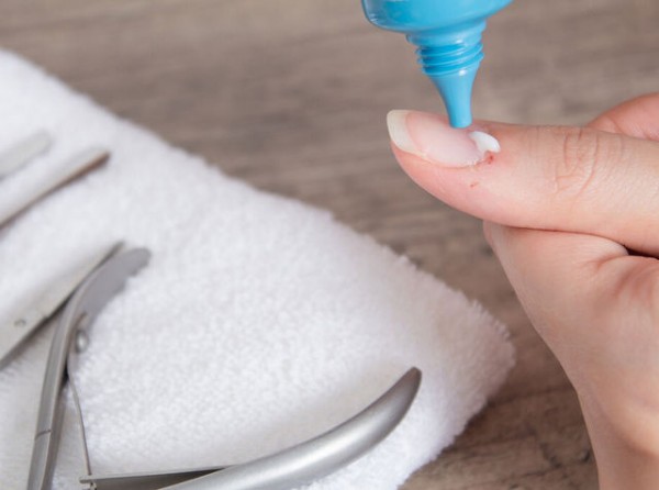 Απαλλαγείτε από τις παρανυχίδες οριστικά!