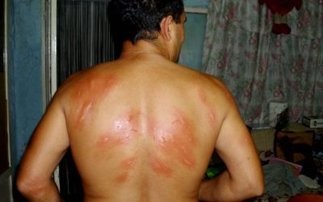 Επιδρομή κουνουπιών στα Κριεζά!