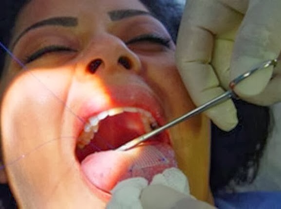 Η πιο ακραία δίαιτα που κυκλοφορεί