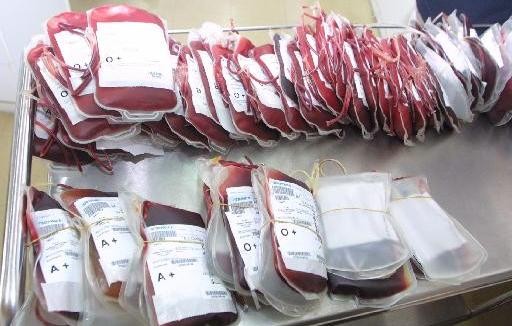 Κοστίζει τριπλάσια το αίμα στην Ελλάδα από το εισαγόμενο