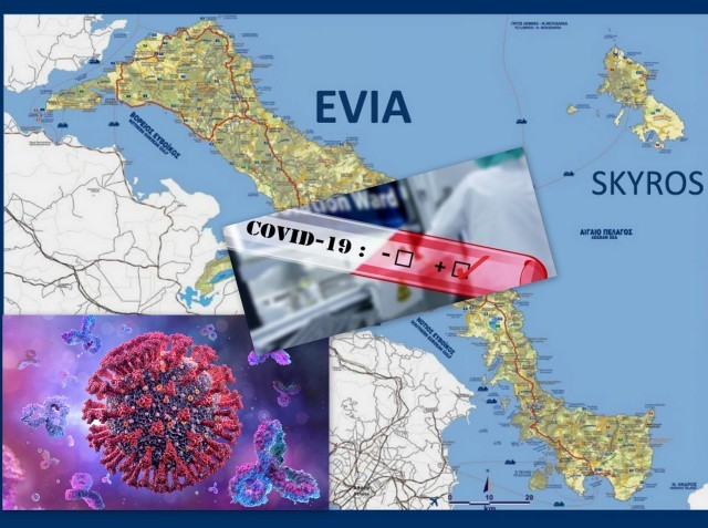 ΚΟΡΩΝΟΪΟΣ: Άλμα των κρουσμάτων στα 93 σήμερα Τρίτη στην  Εύβοια