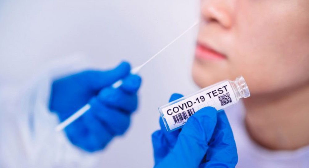 ΔΗΜΟΣ ΧΑΛΚΙΔΕΩΝ: Μόνο στη Χαλκίδα δωρεάν rapid test αυτή την εβδομάδα