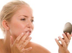 Σημάδια από σπυράκια τέλος!